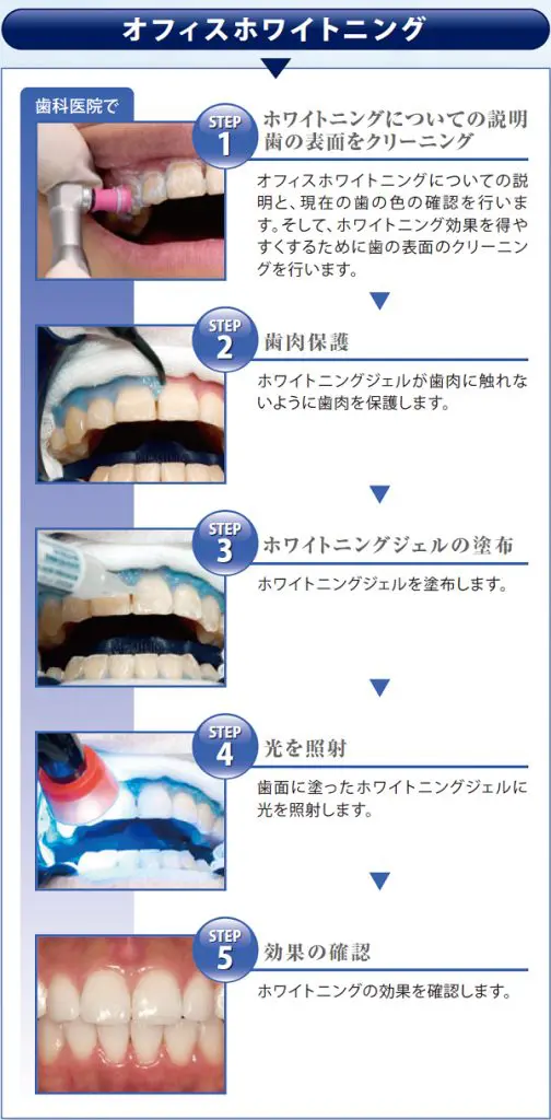 ホワイトニング | ひかり歯科クリニック